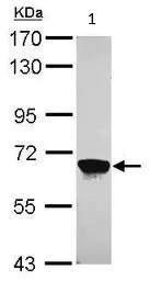 Western blot - Anti-MPP2/DLG2 antibody (AB97290)