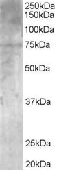 Western blot - Anti-MPP5/Pals1 antibody (AB20511)