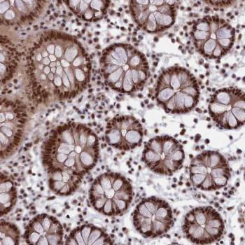 Immunohistochemistry (Formalin/PFA-fixed paraffin-embedded sections) - Anti-MPP8 antibody (AB122611)