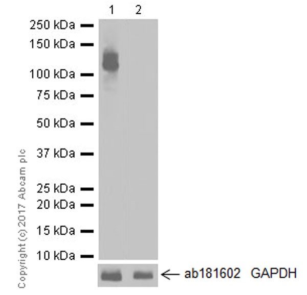 Western blot - Anti-MPP8 antibody [EPR19856] - BSA and Azide free (AB226860), expandable thumbnail