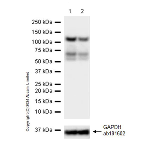 Western blot - Anti-MPP8 antibody [EPR28268-120] (AB322868)