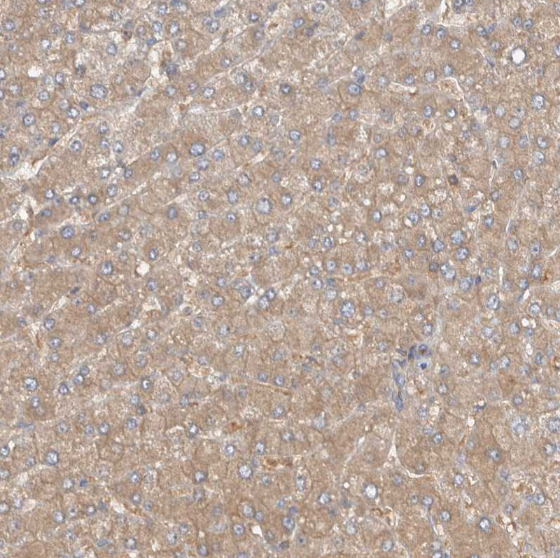 Immunohistochemistry (Formalin/PFA-fixed paraffin-embedded sections) - Anti-MPRIP antibody (AB251741), expandable thumbnail
