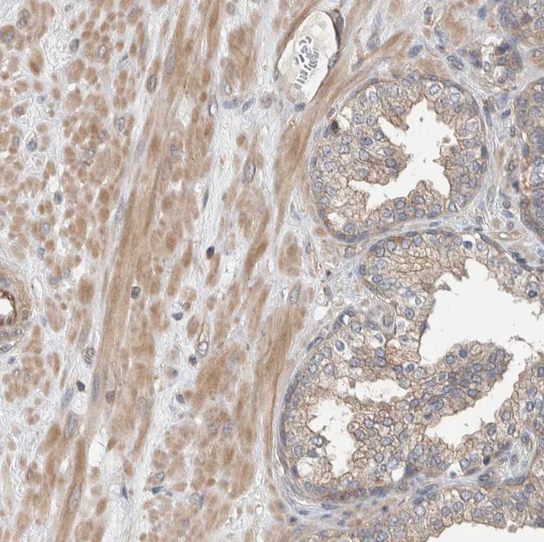 Immunohistochemistry (Formalin/PFA-fixed paraffin-embedded sections) - Anti-MPRIP antibody (AB251741)