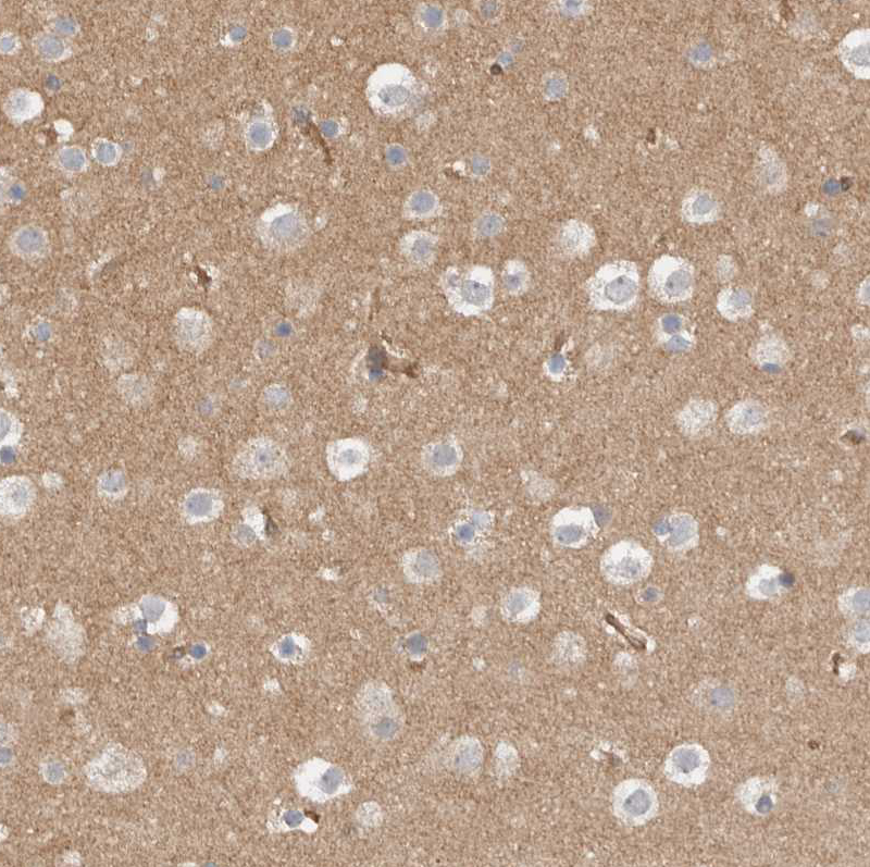 Immunohistochemistry (Formalin/PFA-fixed paraffin-embedded sections) - Anti-MPRIP antibody (AB251741), expandable thumbnail