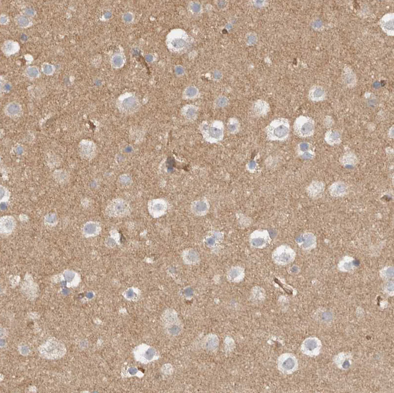 Immunohistochemistry (Formalin/PFA-fixed paraffin-embedded sections) - Anti-MPRIP antibody (AB251741)