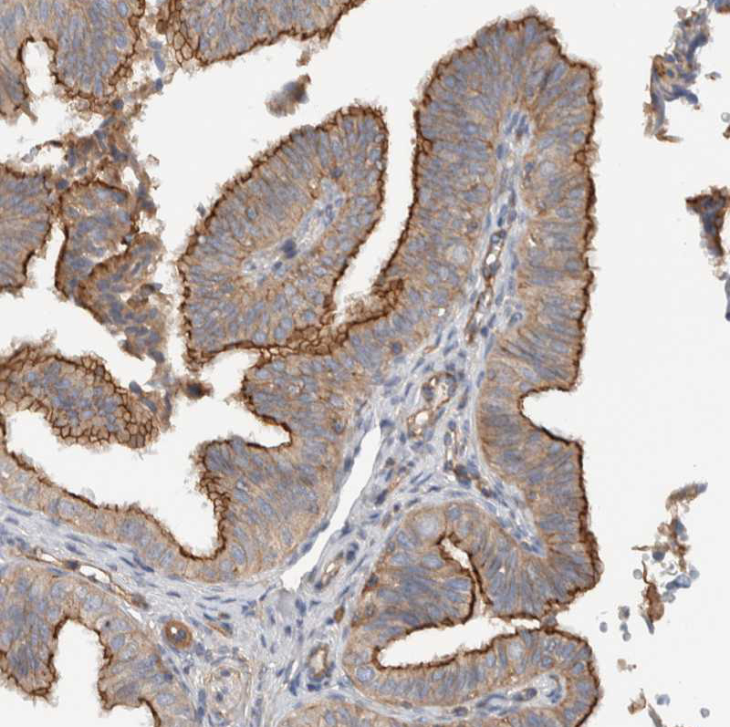 Immunohistochemistry (Formalin/PFA-fixed paraffin-embedded sections) - Anti-MPRIP antibody (AB251741), expandable thumbnail