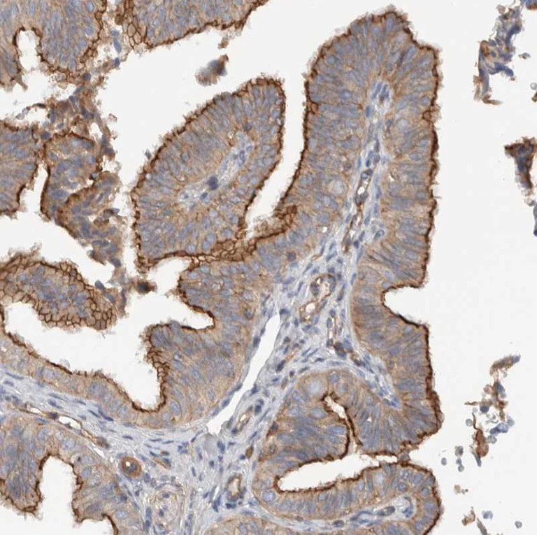 Immunohistochemistry (Formalin/PFA-fixed paraffin-embedded sections) - Anti-MPRIP antibody (AB251741)