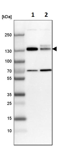 Western blot - Anti-MPRIP antibody (ab251741), expandable thumbnail