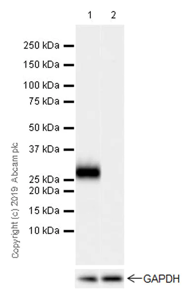 Western blot - Anti-MPTX+MPTX2 antibody [EPR20920-19] (AB238123)