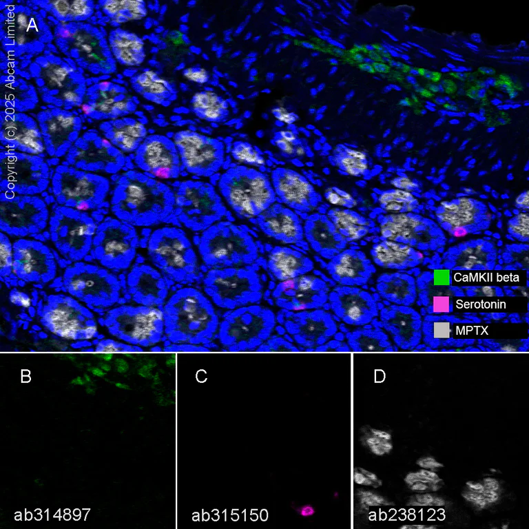 Multiplex immunohistochemistry - Anti-MPTX+MPTX2 antibody [EPR20920-19] - BSA and Azide free (AB269857)