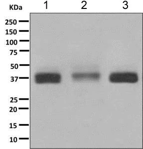 Western blot - Anti-MPZL antibody [EPR9229] (AB151541)