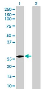 Western blot - Anti-MPZL3 antibody (AB76327)