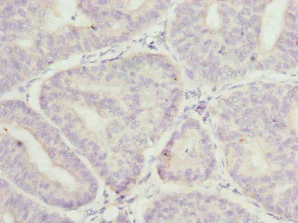 Immunohistochemistry (Formalin/PFA-fixed paraffin-embedded sections) - Anti-MR1 antibody (AB229715)