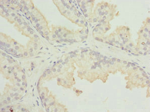 Immunohistochemistry (Formalin/PFA-fixed paraffin-embedded sections) - Anti-MR1 antibody (AB229715)