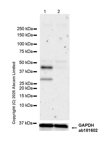 Western blot - Anti-MR1 antibody [EPR30434-652] (AB325648)