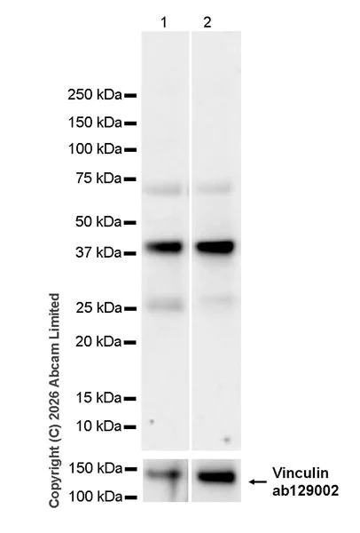 Western blot - Anti-MR1 antibody [EPR30434-652] (AB325648)