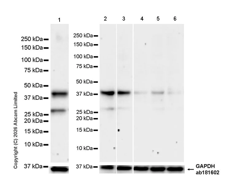 Western blot - Anti-MR1 antibody [EPR30434-652] - BSA and Azide free (AB325655)