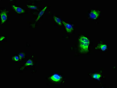 Immunocytochemistry/ Immunofluorescence - Anti-MRAP2 antibody (AB237537)