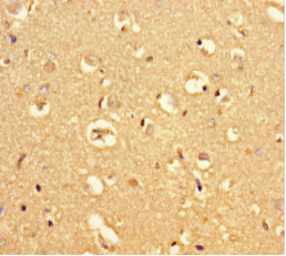 Immunohistochemistry (Formalin/PFA-fixed paraffin-embedded sections) - Anti-MRAP2 antibody (AB237537)
