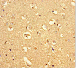 Immunohistochemistry (Formalin/PFA-fixed paraffin-embedded sections) - Anti-MRAP2 antibody (AB237537)
