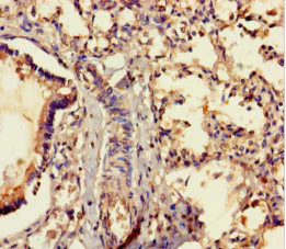 Immunohistochemistry (Formalin/PFA-fixed paraffin-embedded sections) - Anti-MRAP2 antibody (AB237537)