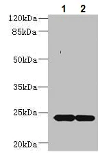 Western blot - Anti-MRAP2 antibody (AB237537)
