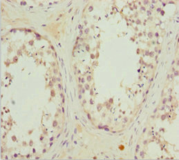 Immunohistochemistry (Formalin/PFA-fixed paraffin-embedded sections) - Anti-MRas antibody (AB230245)