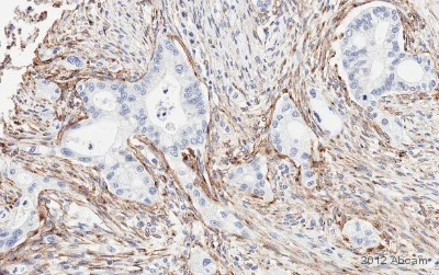 Immunohistochemistry (Formalin/PFA-fixed paraffin-embedded sections) - Anti-MRC2/ENDO180 antibody (AB70132)