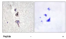Immunohistochemistry (Formalin/PFA-fixed paraffin-embedded sections) - Anti-MRC2/ENDO180 antibody (AB70132)