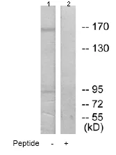 Western blot - Anti-MRC2/ENDO180 antibody (AB70132)