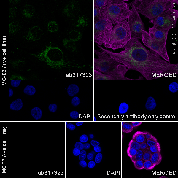 Immunocytochemistry/ Immunofluorescence - Anti-MRC2/ENDO180 antibody [EPR29048-48] (AB317323), expandable thumbnail