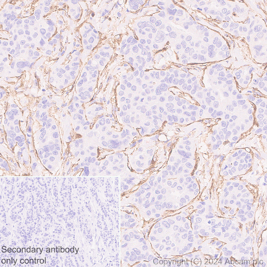 Immunohistochemistry (Formalin/PFA-fixed paraffin-embedded sections) - Anti-MRC2/ENDO180 antibody [EPR29048-48] (ab317323), expandable thumbnail