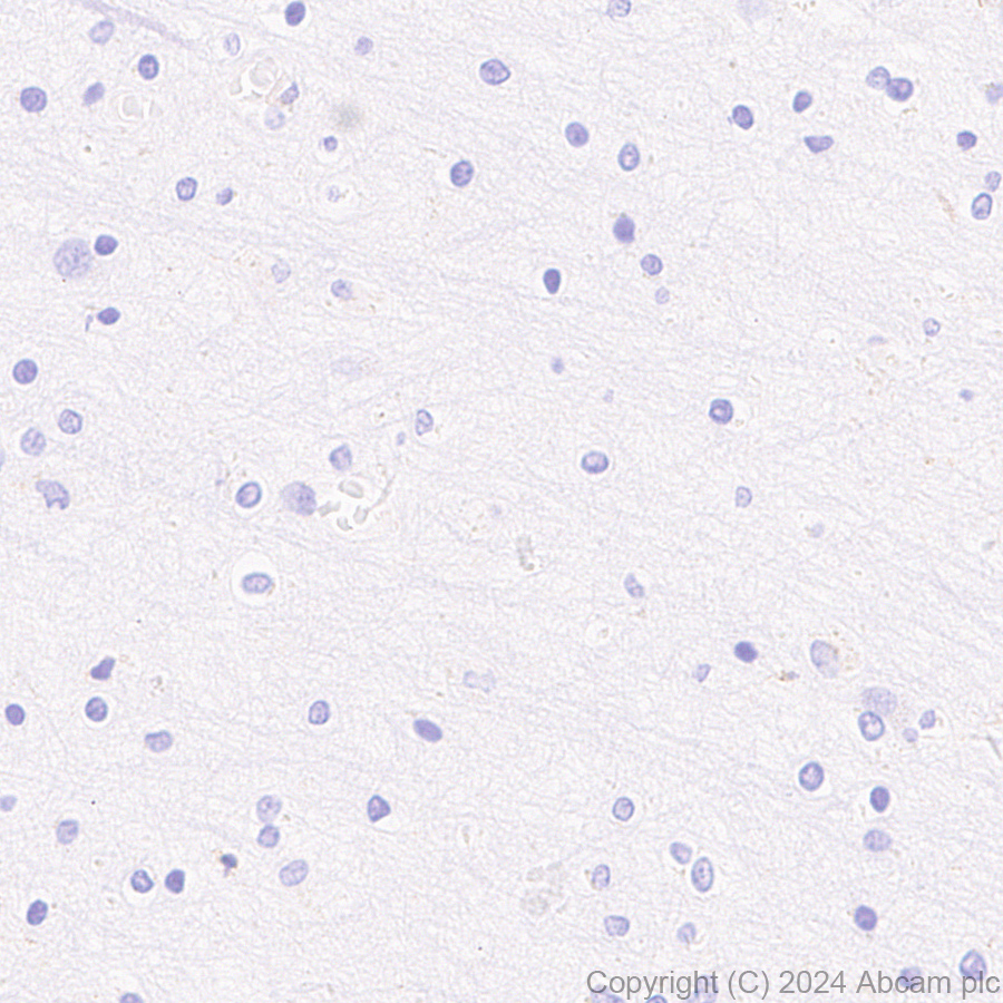 Immunohistochemistry (Formalin/PFA-fixed paraffin-embedded sections) - Anti-MRC2/ENDO180 antibody [EPR29048-48] (AB317323), expandable thumbnail