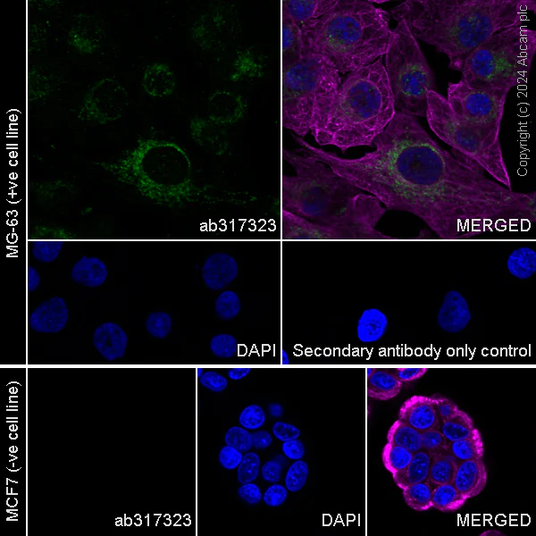 Immunocytochemistry/ Immunofluorescence - Anti-MRC2/ENDO180 antibody [EPR29048-48] - BSA and Azide free (AB317324)