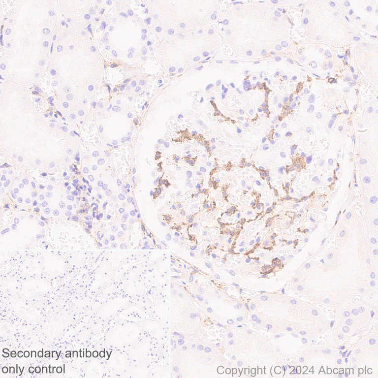 Immunohistochemistry (Formalin/PFA-fixed paraffin-embedded sections) - Anti-MRC2/ENDO180 antibody [EPR29048-48] - BSA and Azide free (AB317324)