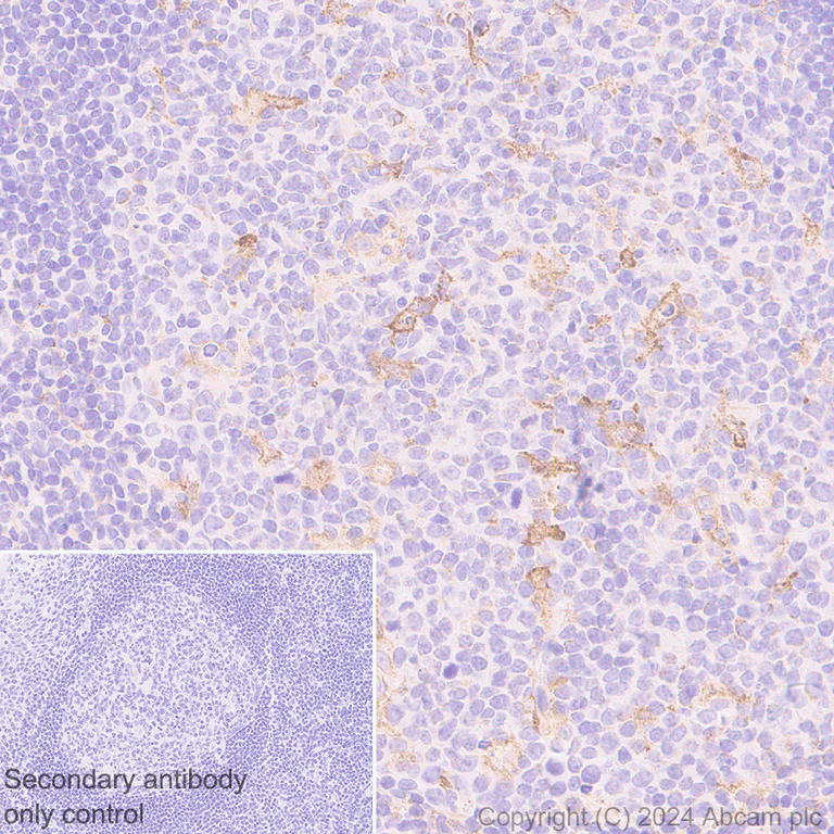Immunohistochemistry (Formalin/PFA-fixed paraffin-embedded sections) - Anti-MRC2/ENDO180 antibody [EPR29048-48] - BSA and Azide free (AB317324)