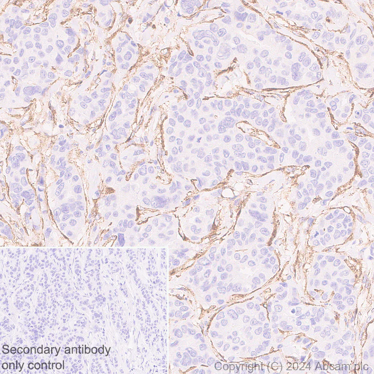 Immunohistochemistry (Formalin/PFA-fixed paraffin-embedded sections) - Anti-MRC2/ENDO180 antibody [EPR29048-48] - BSA and Azide free (AB317324)
