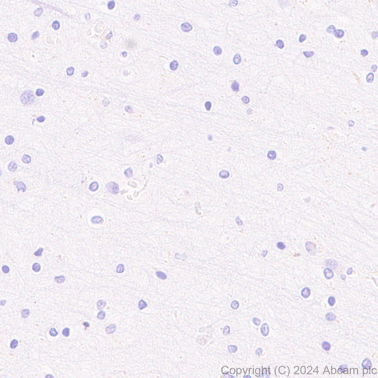 Immunohistochemistry (Formalin/PFA-fixed paraffin-embedded sections) - Anti-MRC2/ENDO180 antibody [EPR29048-48] - BSA and Azide free (AB317324)