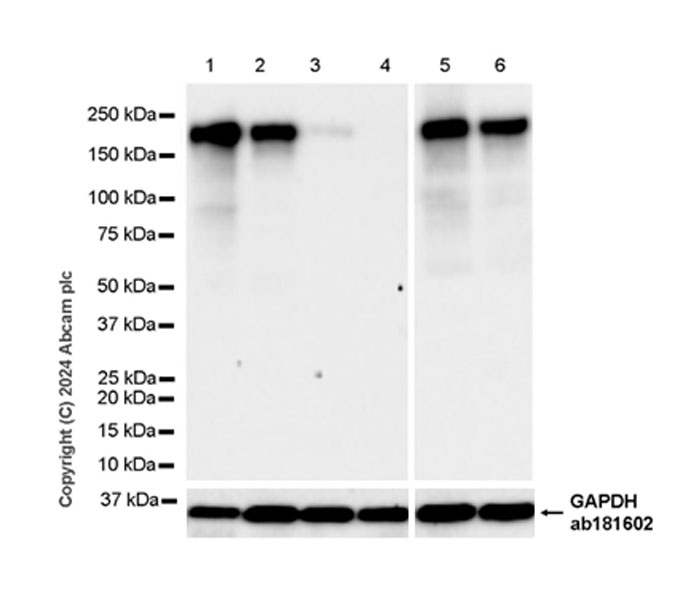 Western blot - Anti-MRC2/ENDO180 antibody [EPR29048-78] (AB317748), expandable thumbnail