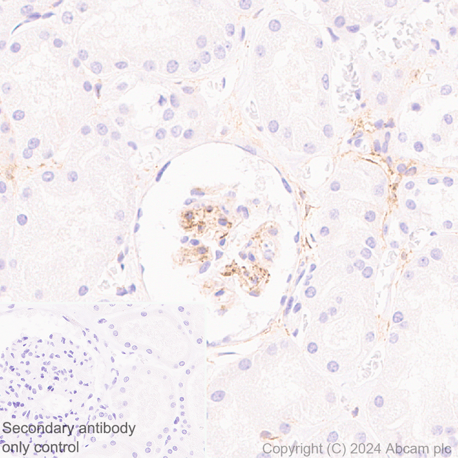 Immunohistochemistry (Formalin/PFA-fixed paraffin-embedded sections) - Anti-MRC2/ENDO180 antibody [EPR29048-78] - BSA and Azide free (ab317749), expandable thumbnail