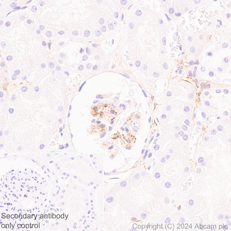 Immunohistochemistry (Formalin/PFA-fixed paraffin-embedded sections) - Anti-MRC2/ENDO180 antibody [EPR29048-78] - BSA and Azide free (AB317749)