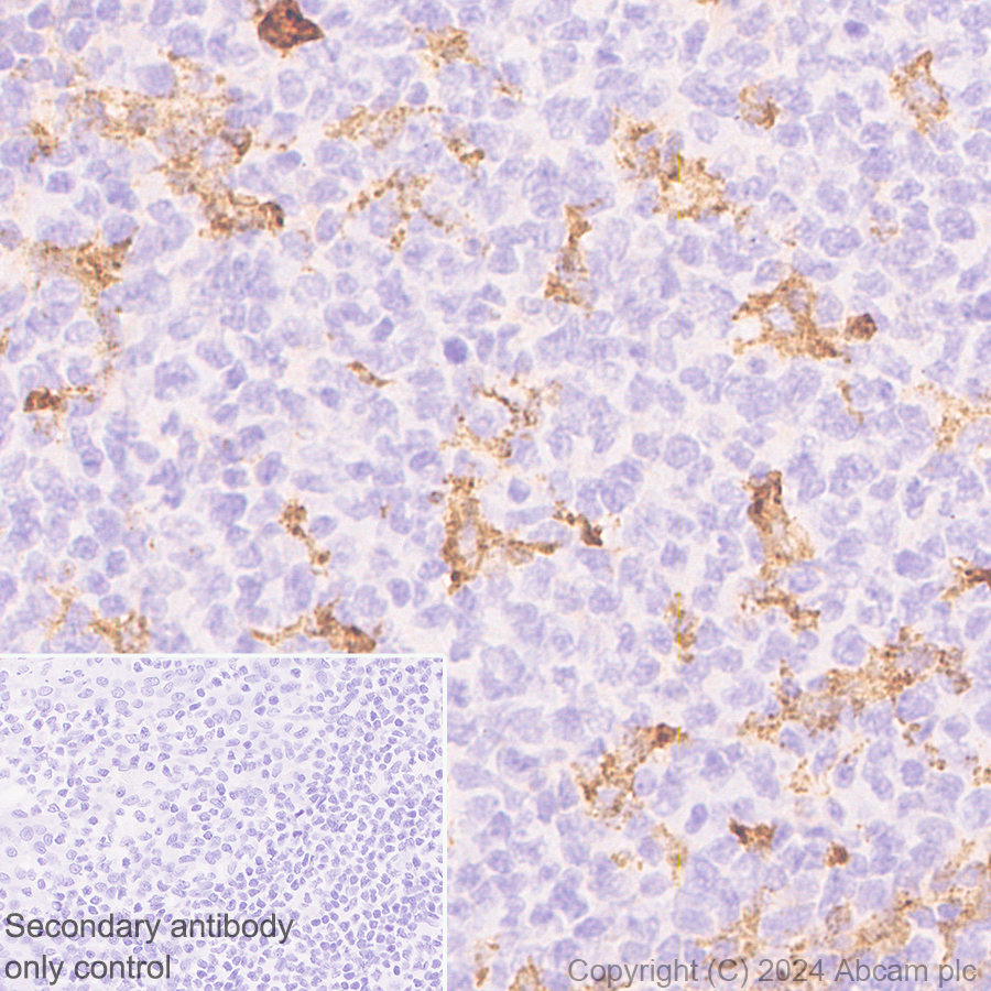 Immunohistochemistry (Formalin/PFA-fixed paraffin-embedded sections) - Anti-MRC2/ENDO180 antibody [EPR29048-78] - BSA and Azide free (ab317749), expandable thumbnail