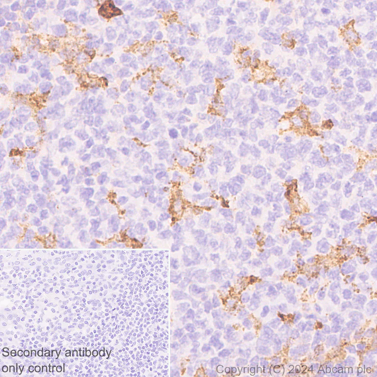 Immunohistochemistry (Formalin/PFA-fixed paraffin-embedded sections) - Anti-MRC2/ENDO180 antibody [EPR29048-78] - BSA and Azide free (AB317749)