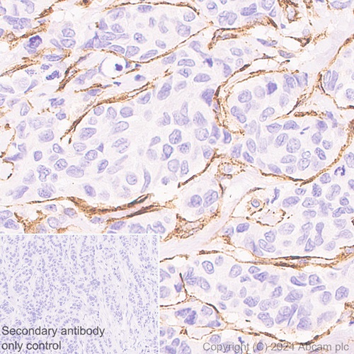 Immunohistochemistry (Formalin/PFA-fixed paraffin-embedded sections) - Anti-MRC2/ENDO180 antibody [EPR29048-78] - BSA and Azide free (ab317749), expandable thumbnail