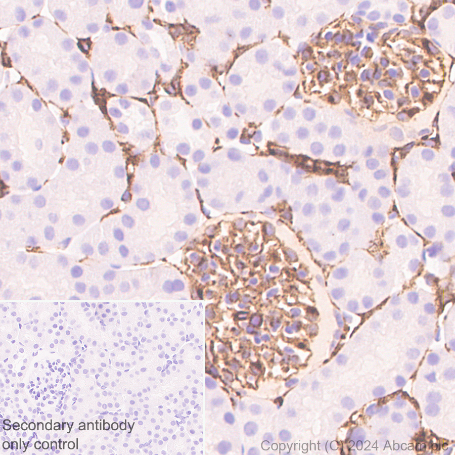 Immunohistochemistry (Formalin/PFA-fixed paraffin-embedded sections) - Anti-MRC2/ENDO180 antibody [EPR29048-78] - BSA and Azide free (ab317749), expandable thumbnail