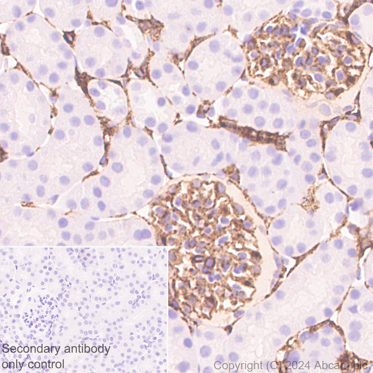 Immunohistochemistry (Formalin/PFA-fixed paraffin-embedded sections) - Anti-MRC2/ENDO180 antibody [EPR29048-78] - BSA and Azide free (AB317749)