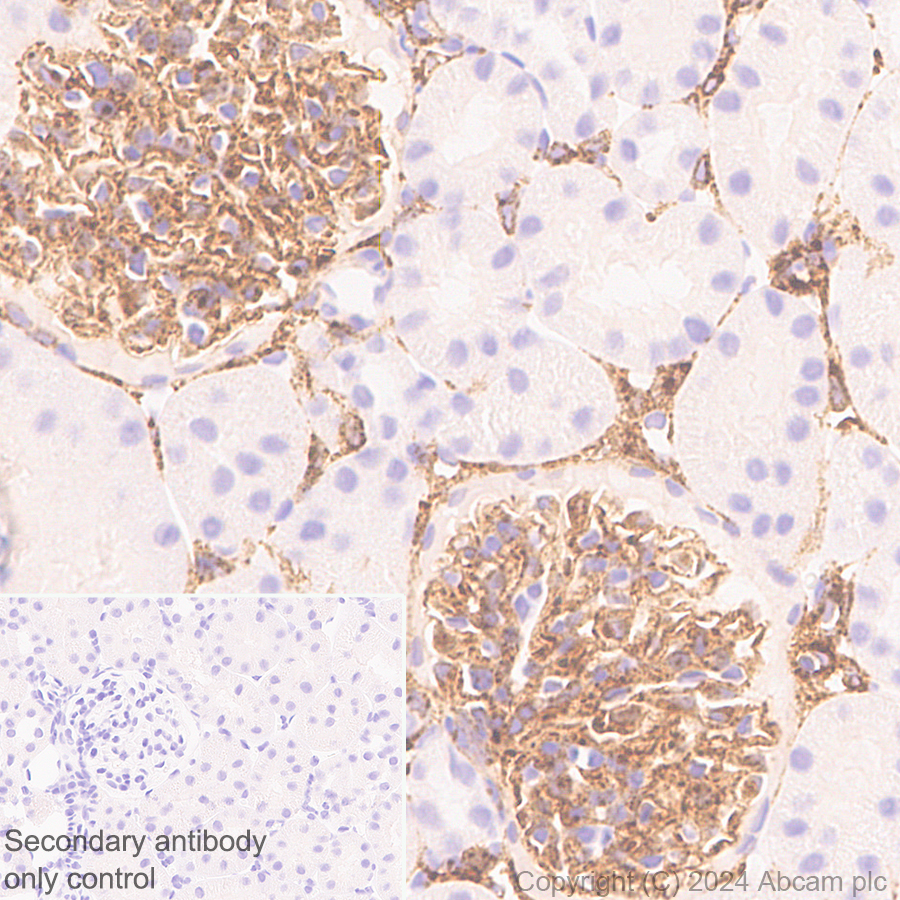 Immunohistochemistry (Formalin/PFA-fixed paraffin-embedded sections) - Anti-MRC2/ENDO180 antibody [EPR29048-78] - BSA and Azide free (ab317749), expandable thumbnail