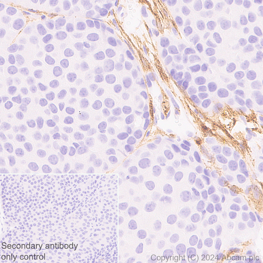 Immunohistochemistry (Formalin/PFA-fixed paraffin-embedded sections) - Anti-MRC2/ENDO180 antibody [EPR29048-78] - BSA and Azide free (ab317749), expandable thumbnail