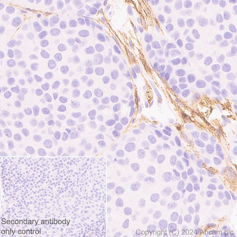 Immunohistochemistry (Formalin/PFA-fixed paraffin-embedded sections) - Anti-MRC2/ENDO180 antibody [EPR29048-78] - BSA and Azide free (AB317749)