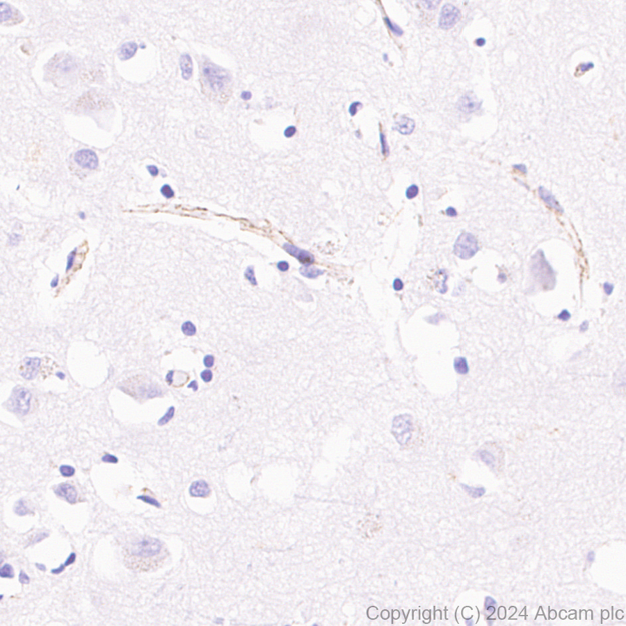 Immunohistochemistry (Formalin/PFA-fixed paraffin-embedded sections) - Anti-MRC2/ENDO180 antibody [EPR29048-78] - BSA and Azide free (ab317749), expandable thumbnail
